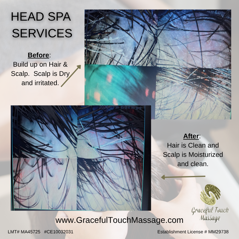 Original Graceful Touch scalp condition before and after photographs